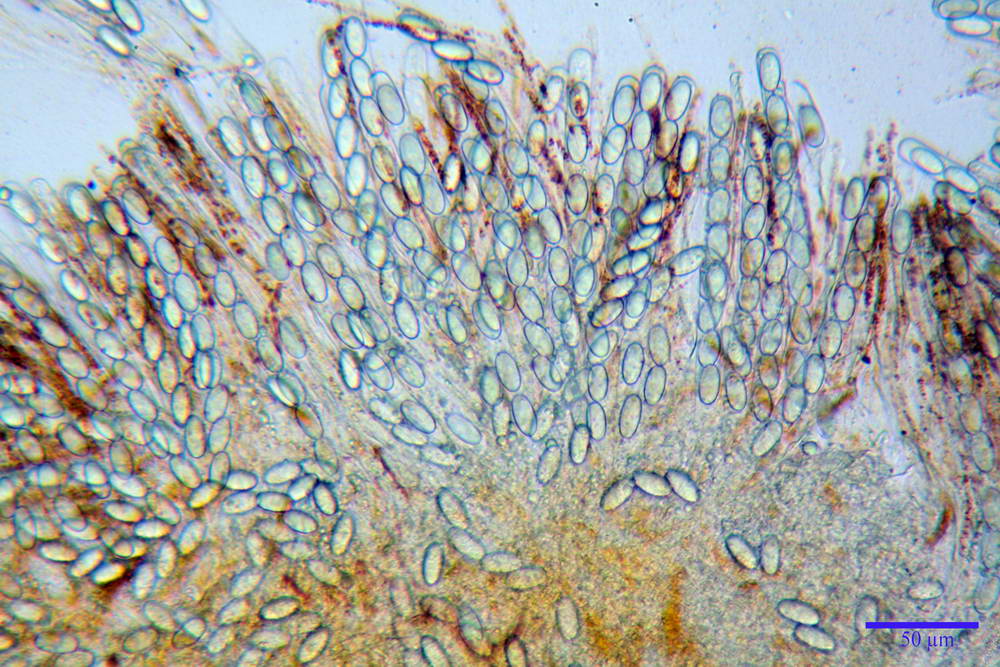 cheilimenia stercorea 4900 41.jpg