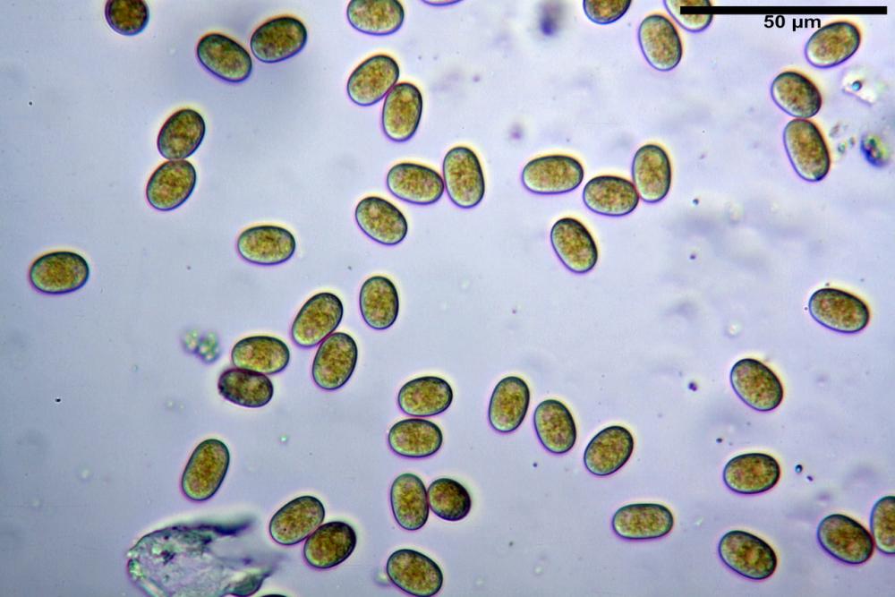 pilobolus crystallinus var kleinii 19_resize.jpg