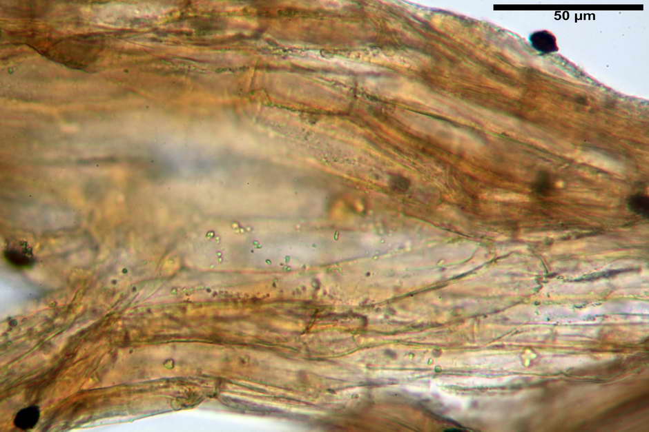 lacrymaria pyrotricha 4812 12.jpg