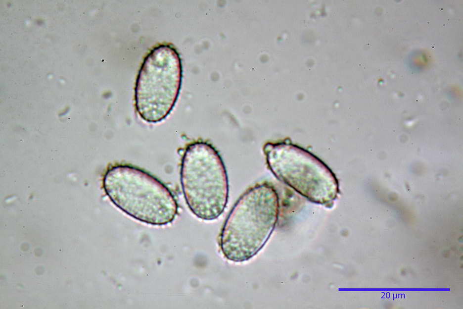 peziza echinospora 4826 62.jpg