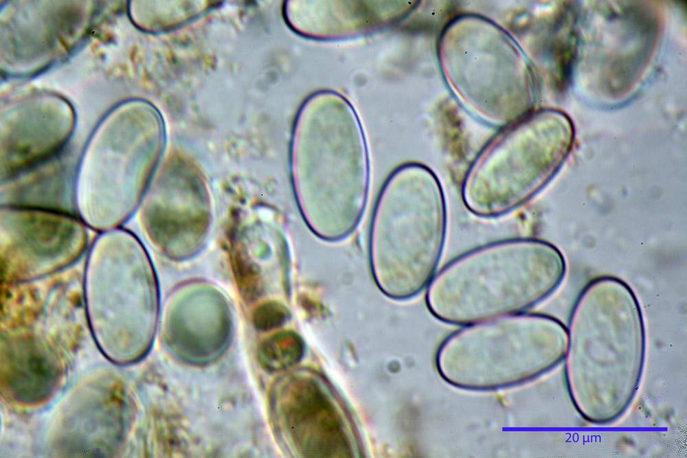 cheilimenia stercorea 4900 55.jpg