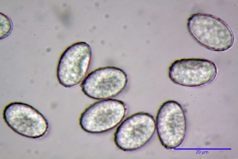 scutellinia 56.jpg