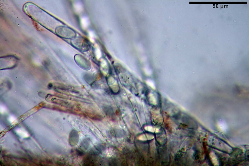 cheilimenia stercorea 4900 34.jpg