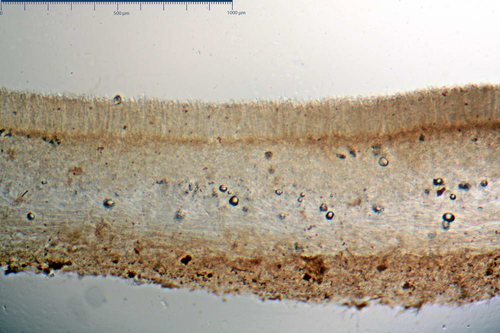 dumontinia tuberosa 5038 08.jpg