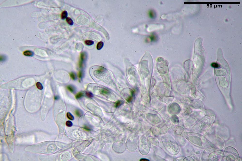 Cyclocybe cilindracea cheilocistidi  01.jpg