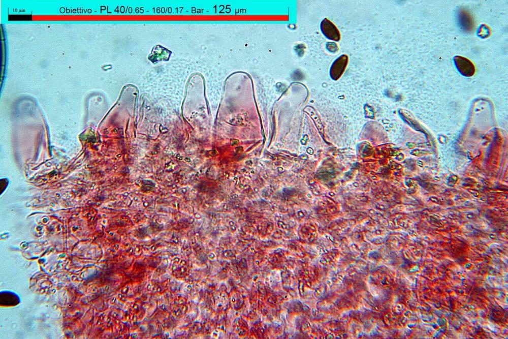 parasola auricoma cheilocistidi 28.jpg