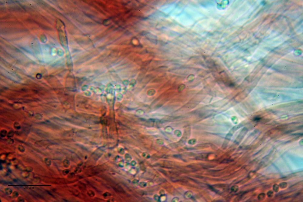Cystodermella cinnabarina 34.JPG