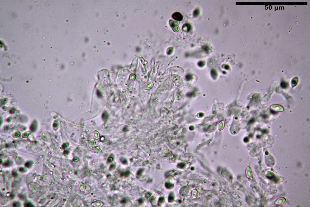leucoagaricus purpureorimosus 4735 19.jpg