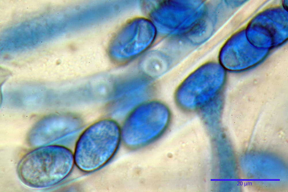 scutellinia crinita 35.jpg
