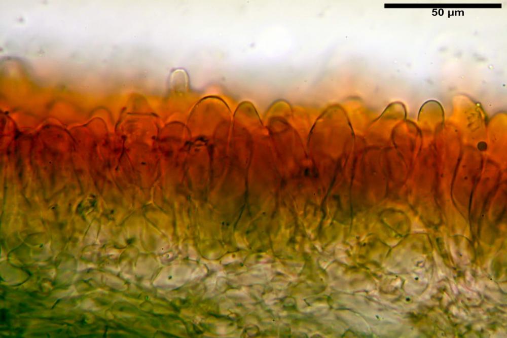 Pluteus thomsonii pileipellis.jpg