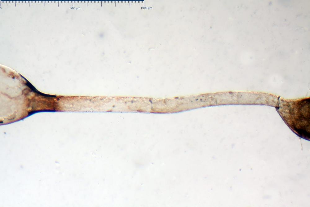 pilobolus crystallinus var kleinii 06_resize.jpg