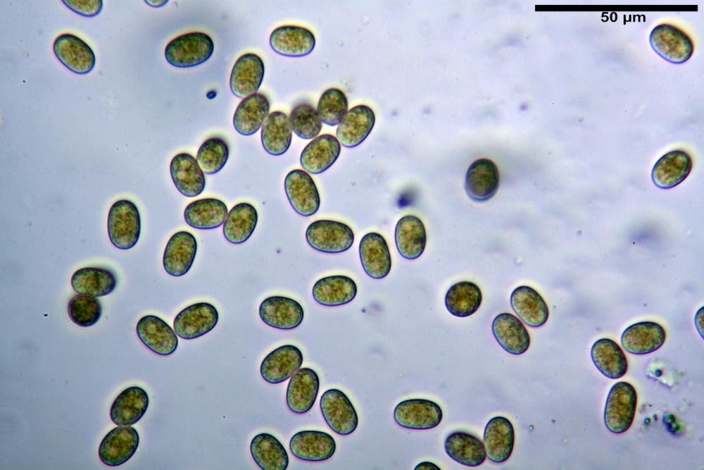 pilobolus crystallinus var kleinii 18_resize.jpg