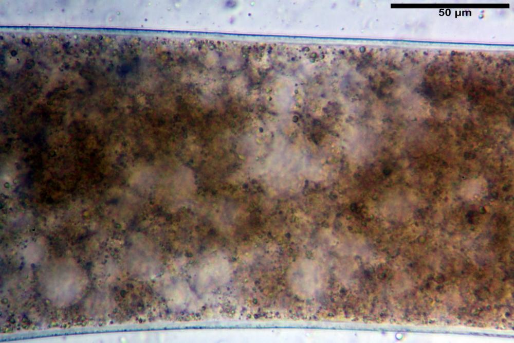 pilobolus crystallinus var kleinii 14_resize.jpg