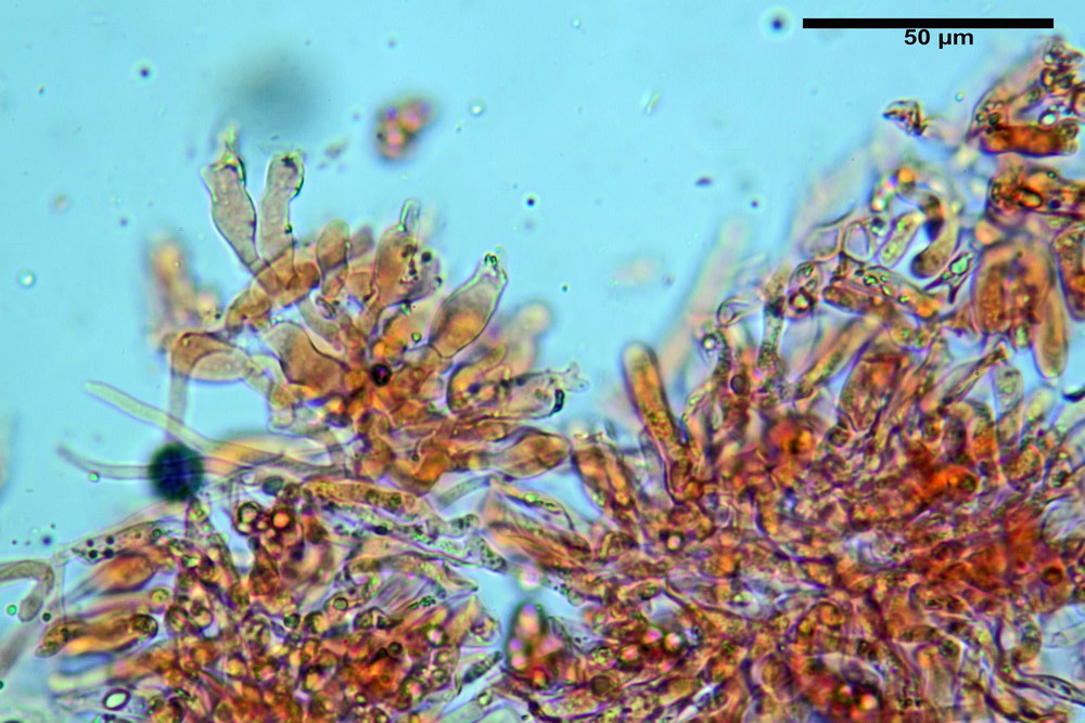 chaetocalathus craterellus 5169 18_resize.jpg