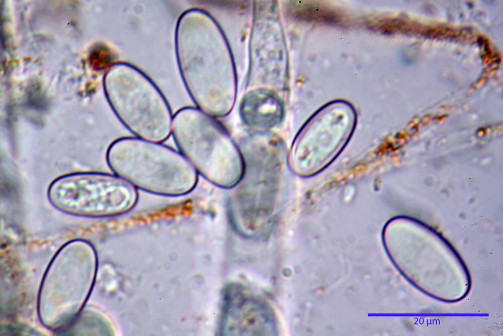 cheilimenia stercorea 4900 47.jpg