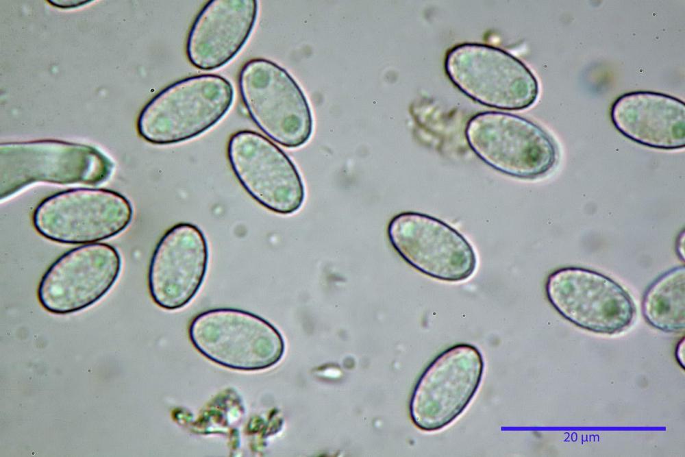 8 peziza subviolacea spore H2O.jpg