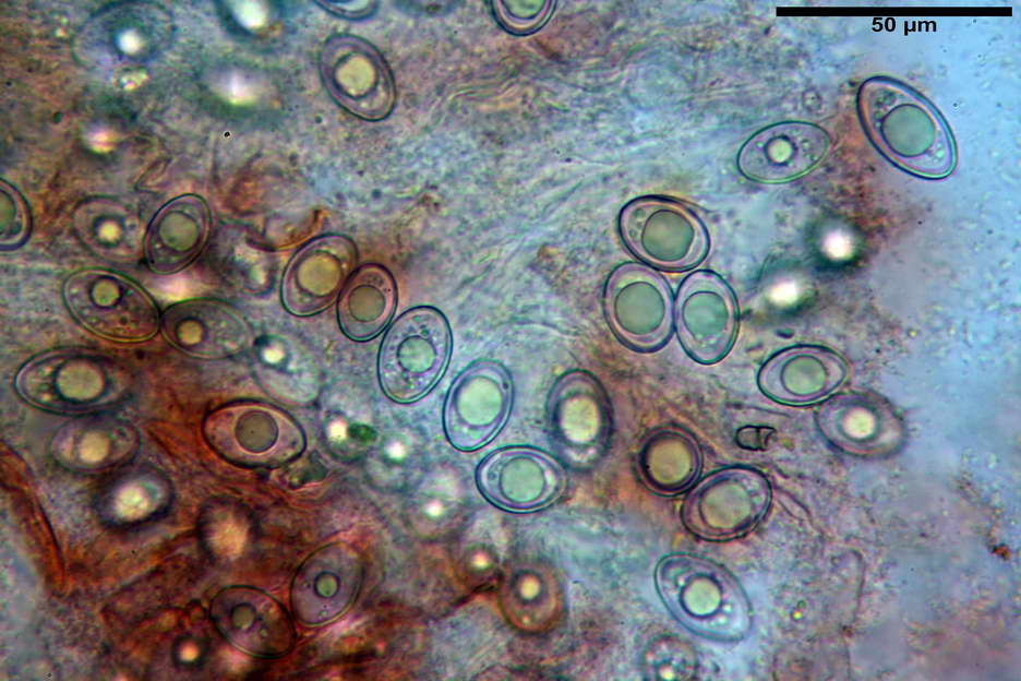 octospora roxheimii 4825 21.jpg