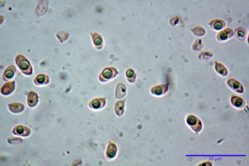 spore luteo-olivaceum 6930 fresco rosso congo amm. 3%.jpg