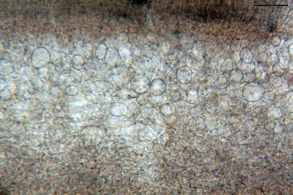 3 peziza echinospora dall'alto subimenio, excipulum medullare superiore - exc. medullare medio.jpg