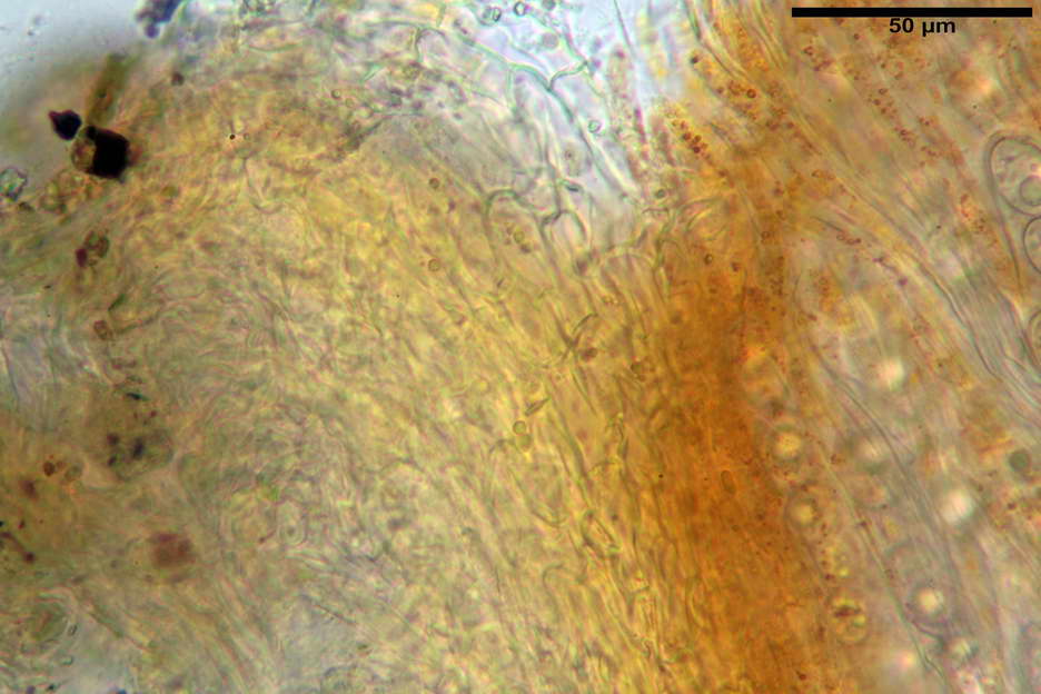 octospora roxheimii 4825 08.jpg