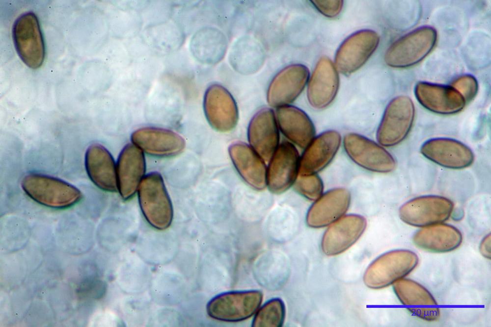 Pholiotina dasypus spore 05.JPG