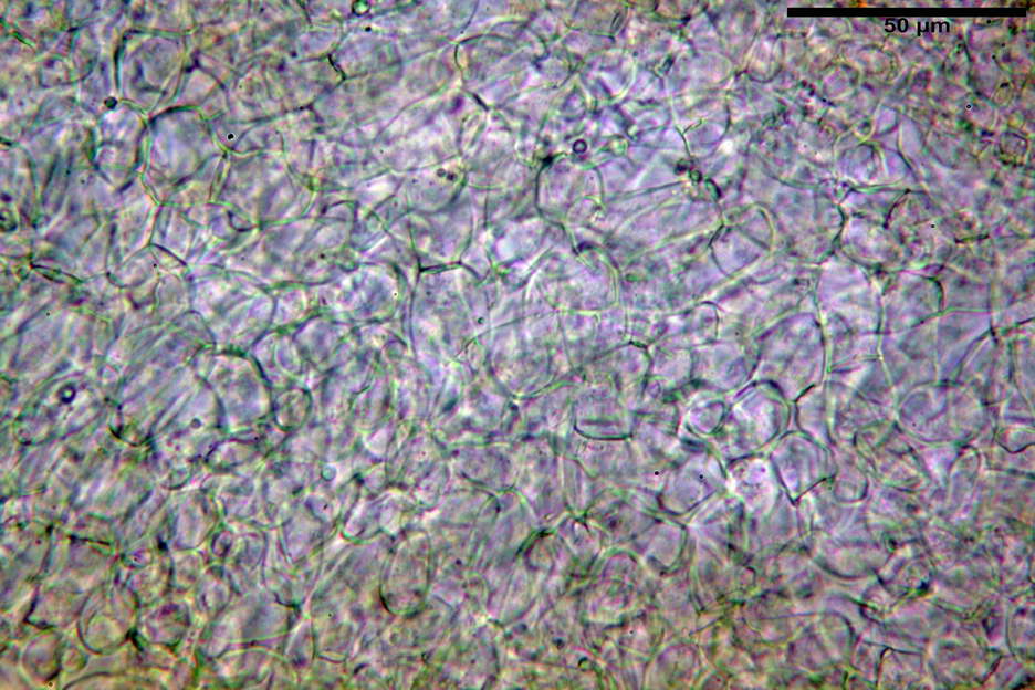 octospora roxheimii 4825 13.jpg