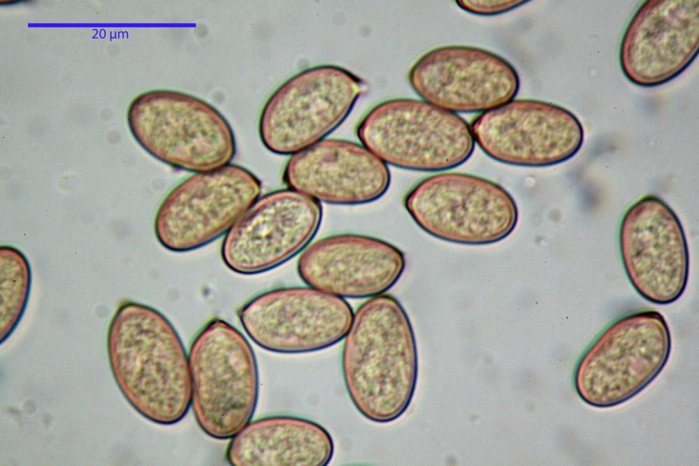 Volvopluteus gloiocephalus spore.jpg