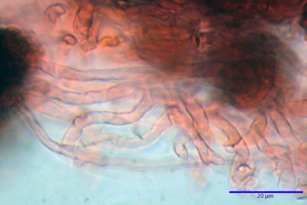 scleroderma citrinum 5366 24.jpg