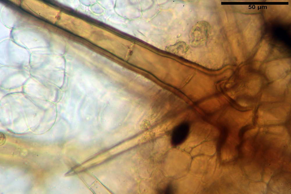 cheilimenia stercorea 4900 30.jpg