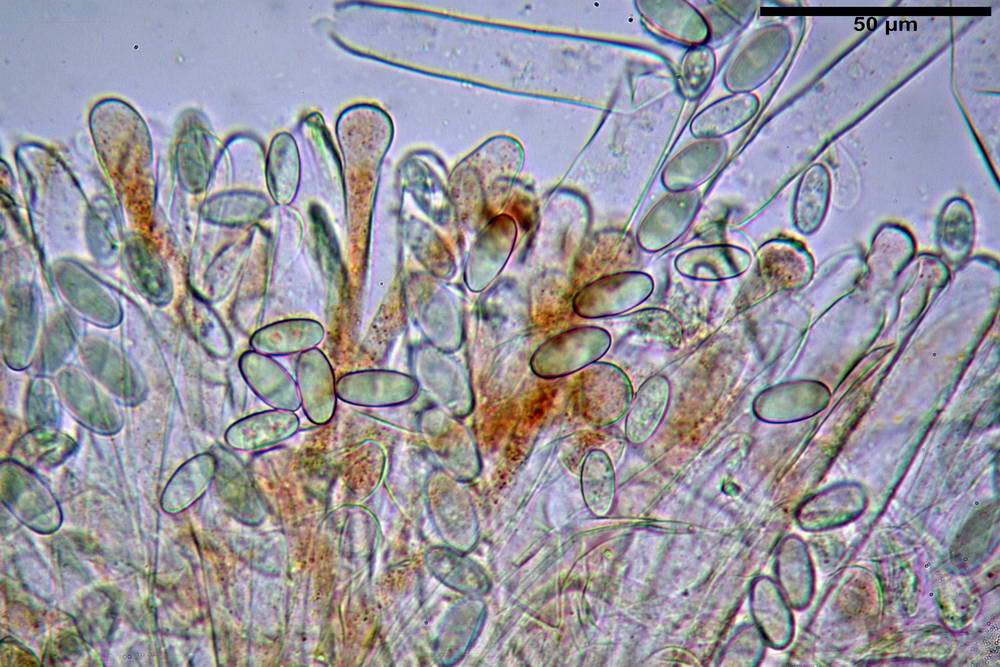cheilimenia granulata 0019 .jpg