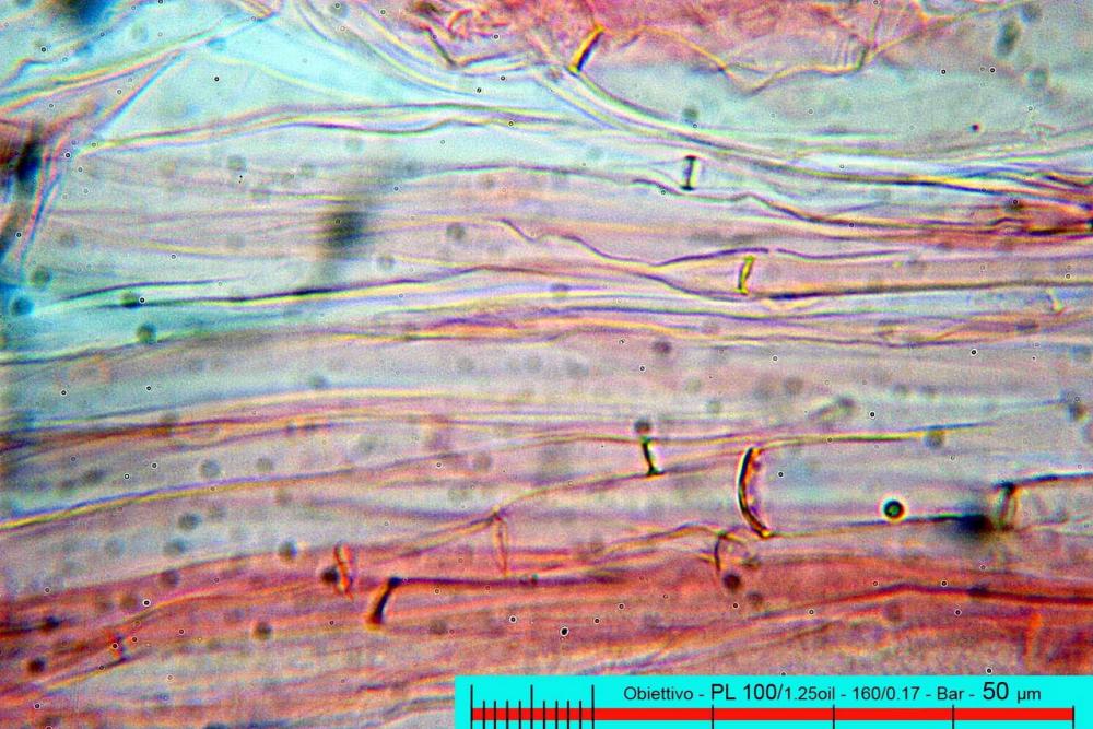 entoloma costatum trama lamellare rosso congo 02.jpg