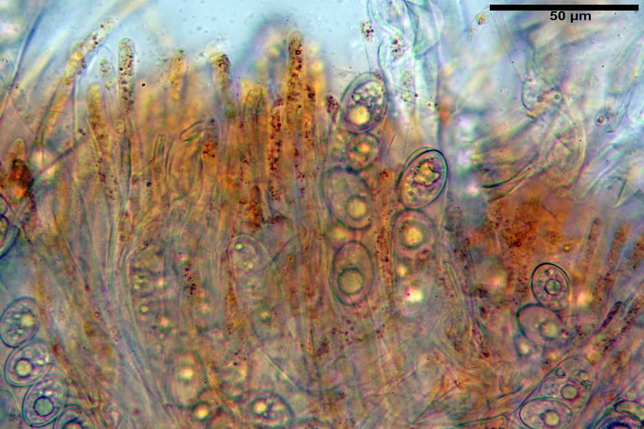 octospora roxheimii 4825 17.jpg