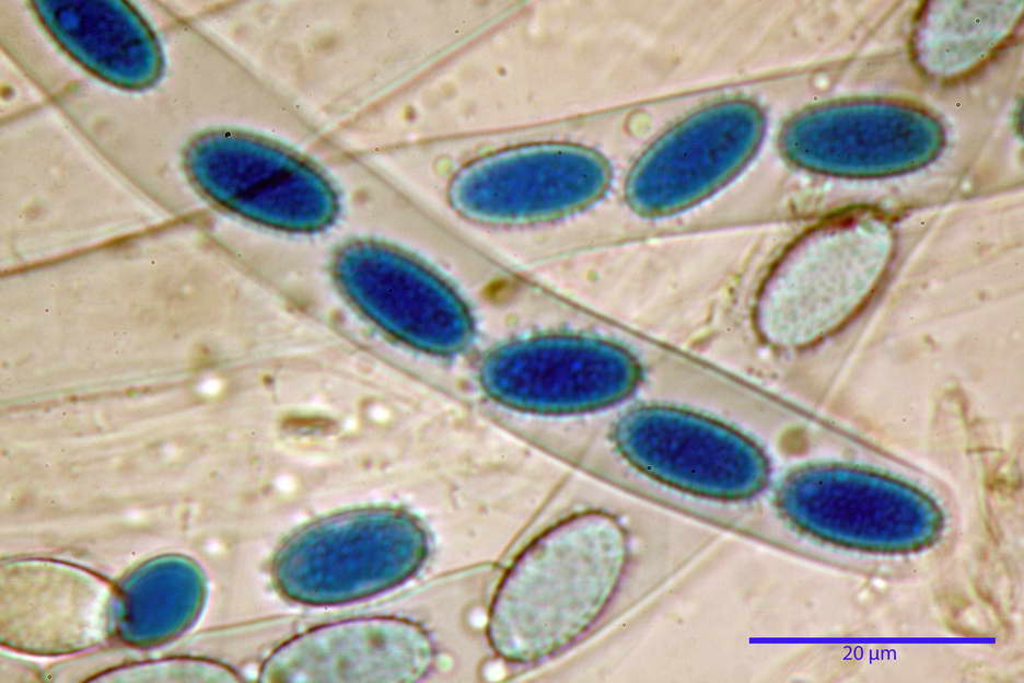 peziza echinospora 4826 73.jpg