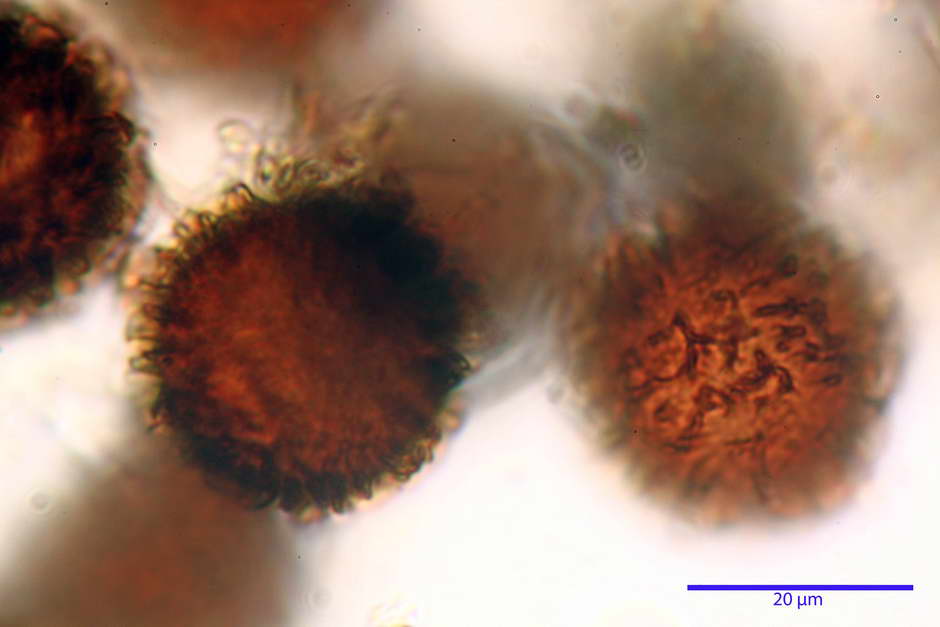 elaphomyces granulatus 4710 27.jpg