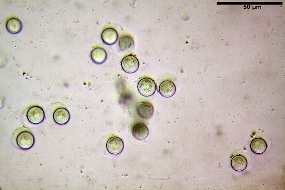 pseudoplectania nigrella 5040 17.jpg