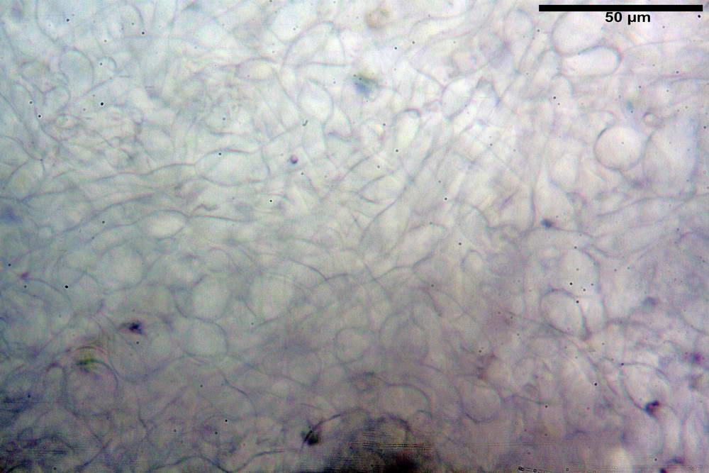 pseudoplectania nigrella 5040 10.jpg
