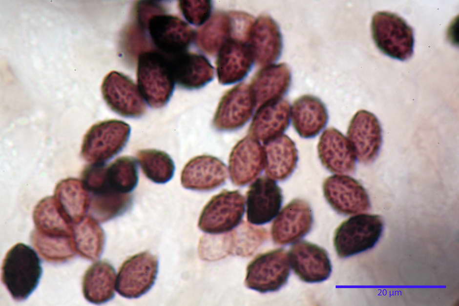 lacrymaria pyrotricha 4812 72.jpg