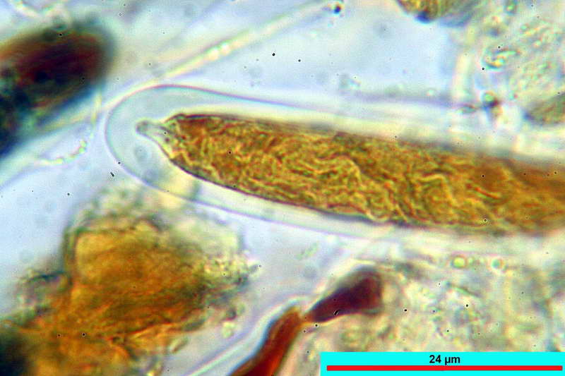 sporomiella_minimoides_2689_34.jpg