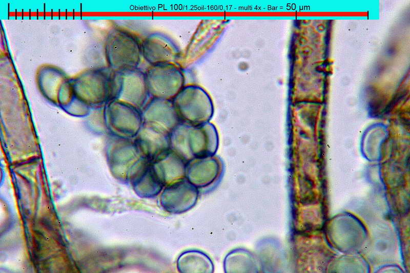 chaetomium_bostrychodes_2732_79.jpg