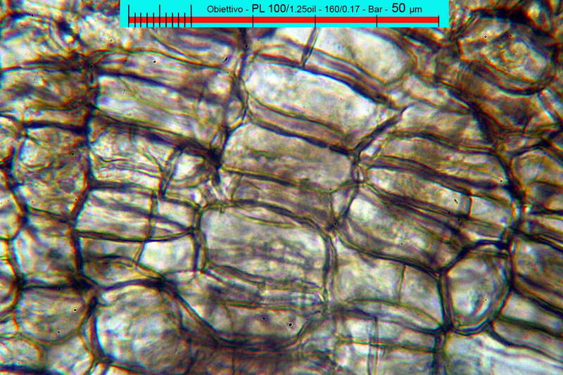 chaetomium_bostrychodes_2732_05.jpg