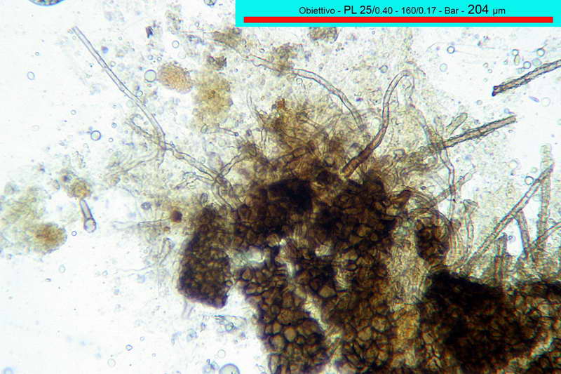 chaetomium_bostrychodes_2732_06.jpg