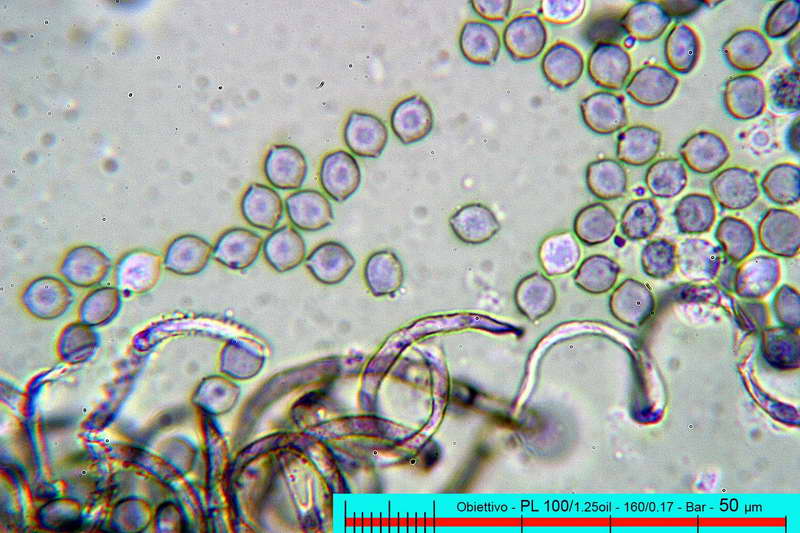 chaetomium_bostrychodes_2732_13.jpg