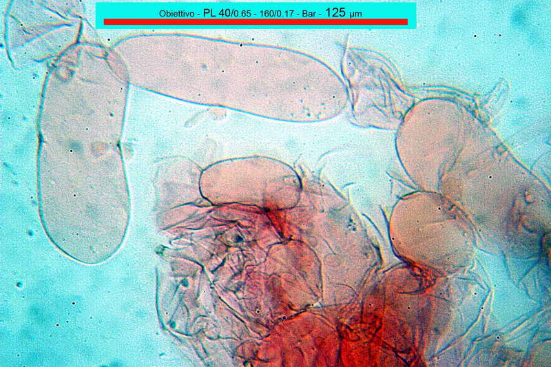 _utriformis_03.jpg