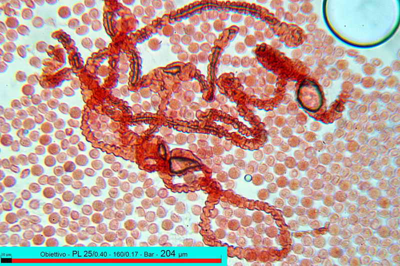 lycogala_epidedrum_2396_04.jpg