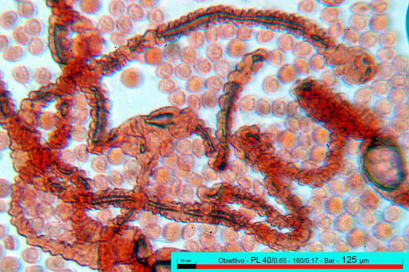 lycogala_epidedrum_2396_05.jpg