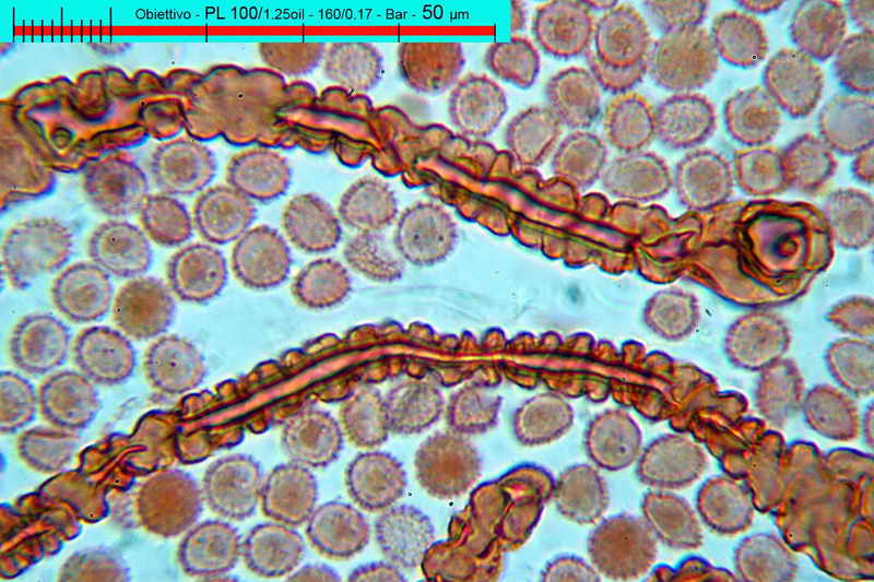 lycogala_epidedrum_2396_06.jpg