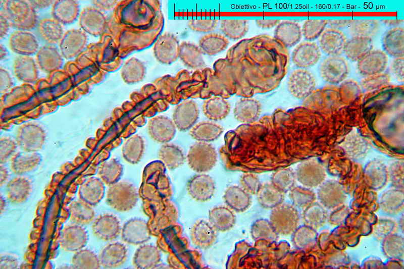 lycogala_epidedrum_2396_07.jpg