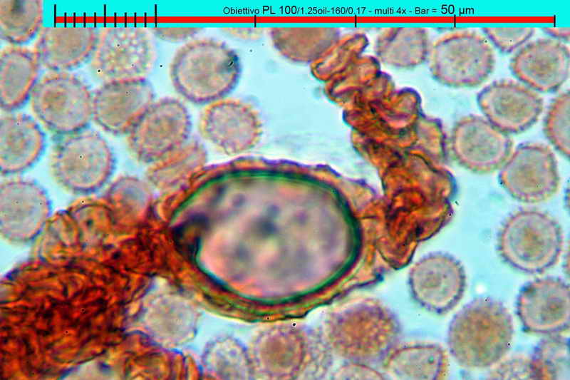 lycogala_epidedrum_2396_08.jpg