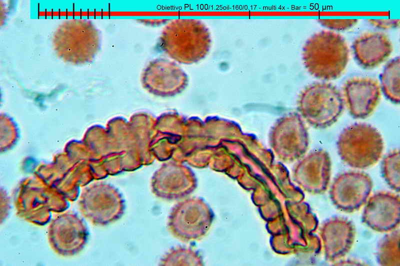 lycogala_epidedrum_2396_09.jpg