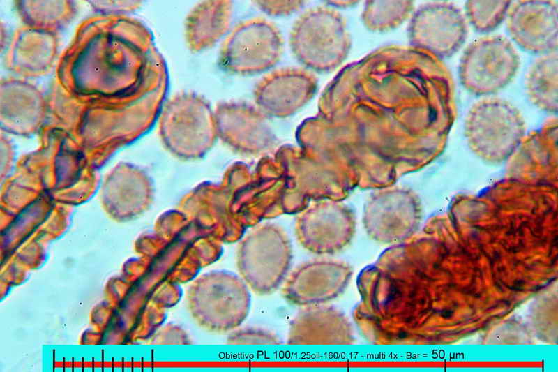 lycogala_epidedrum_2396_10.jpg